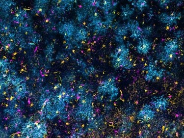 A colorful image of neurons in the brain. Kind of looks like blue trees from above.