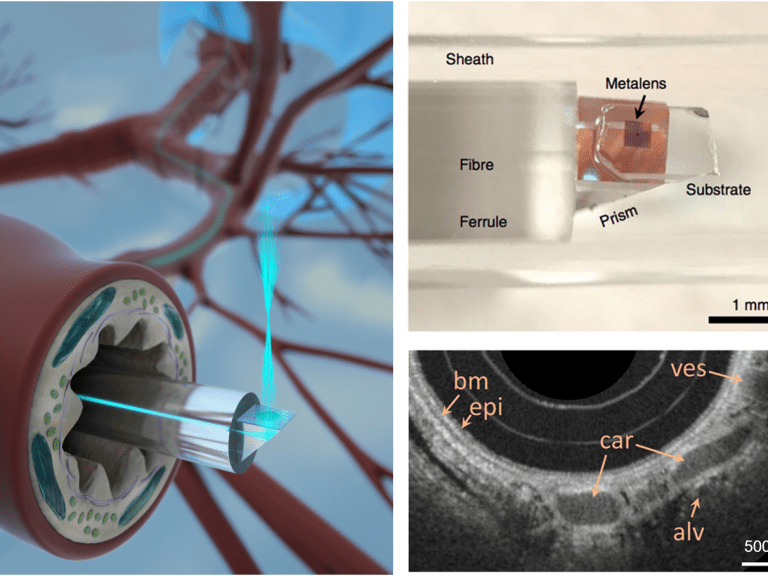 A new type of endoscope
