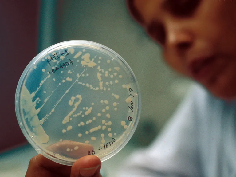 A person holding a petri dish