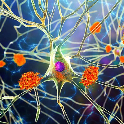 Illustration of neurons