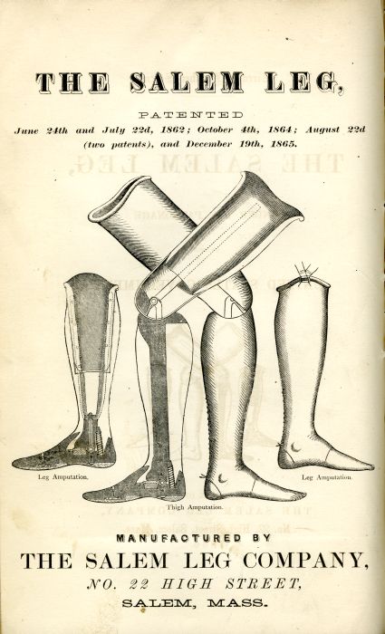 An old advertisement for a prosthetic call the