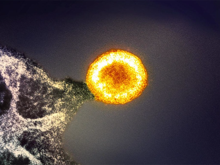 A colorized image of an HIV particle budding from an infected cell